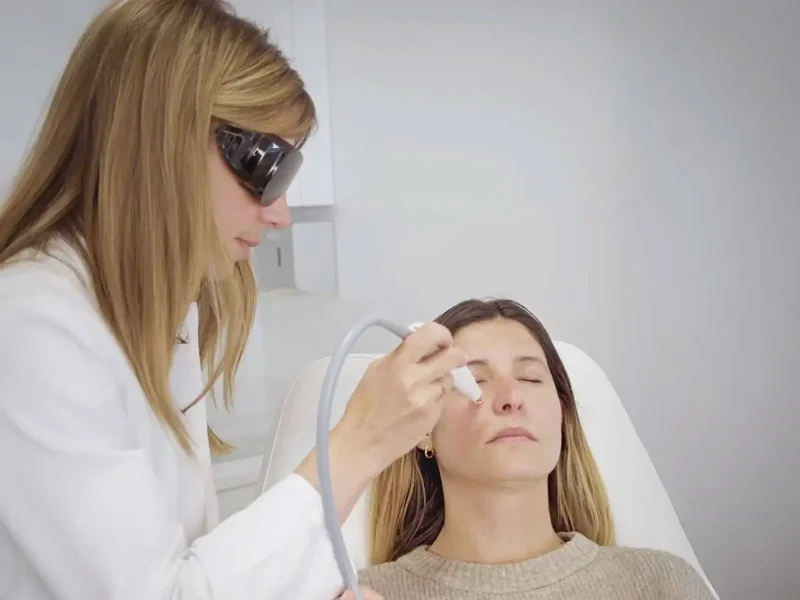 Patiente recevant une séance de lumière intense pulsée au cabinet